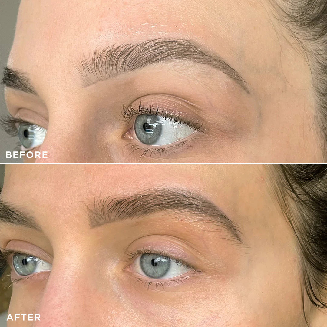 Before and after results of brow serum