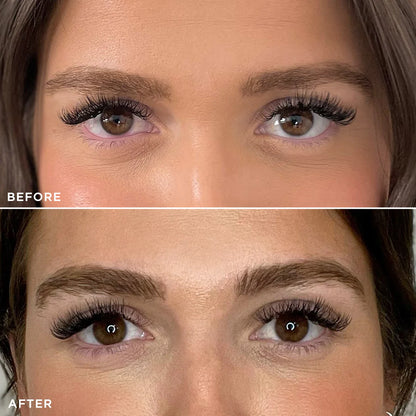 Before and after using Brow Gold Nourishing Growth Oil, showing improved brow fullness and hydration.